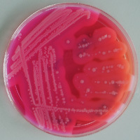 Bacillus cereus