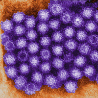 Norovirus (CDC/Charles D. Humphrey)