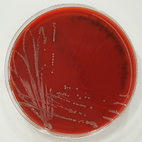 Campylobacter jejuni