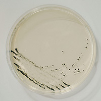 Clostridium perfringens