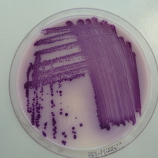 Petrischale mit Nachweis von Salmonella typhimurium auf einen Nährmedium