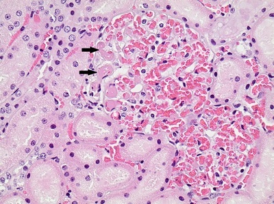 Histologisches Bild Thromben in Nierengefäßen RHDV2 400