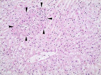 Histologisches Bild Zelluntergänge im Lebergewebe RHDV2 400