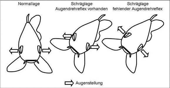 Beurteilung des Augendrehreflexes