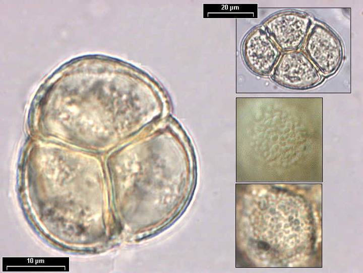 Mikroskopische Aufnahme von Pollen der Besenheide