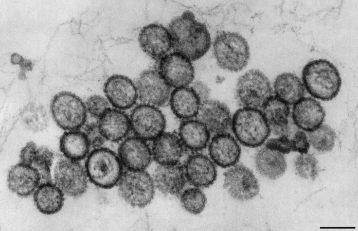 Elektronenmikroskopische Aufnahme von Puumala-Viren (Hanta-Viren)