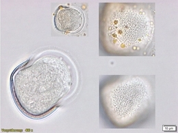 Mikroskopische Bilder eines Spargelpollens