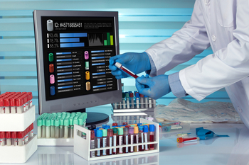 Person in Laborkleidung mit blauen Handschuhen hält eine Probe im Reagenzglas. Im Hintergrund steht ein Bildschirm mit Auswertungsergebnissen. Auf dem Tisch befinden sich Probenbehälter in denen mit Barcodes beklebte Reagenzgläsern stehen.