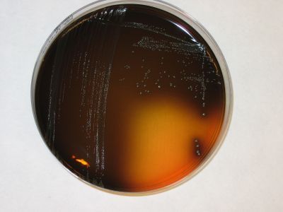 Listeria monocytogenes