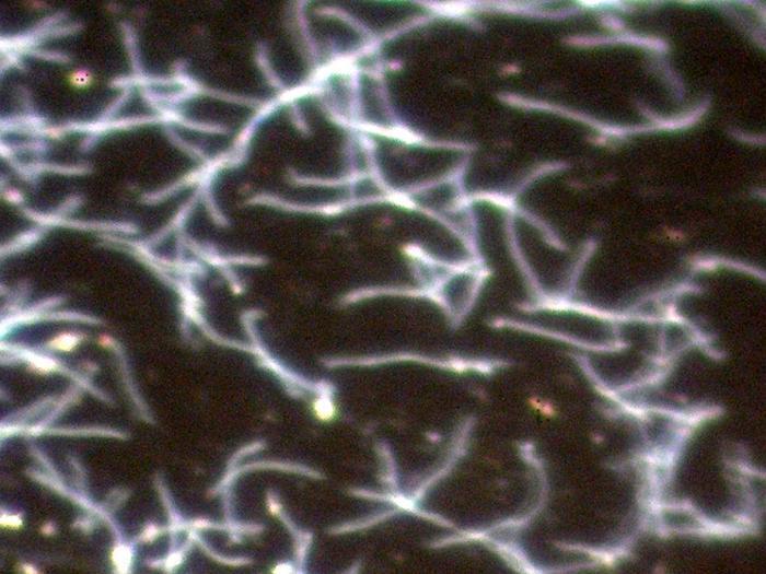 Leptospiren