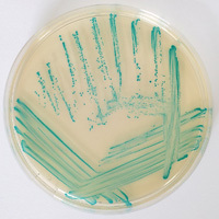 Escherichia coli