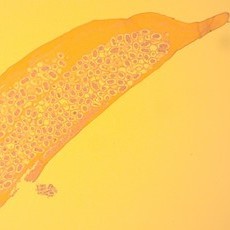 Gefärbter Gewebeschnitt (rundwurm-ähnliche Struktur in der Parasiteneier erkennbar sind)