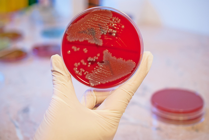Eine rote Petrischale, in der Bakterien des Typs Escherichia coli wachsen.