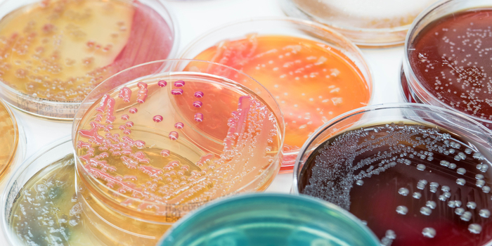 Kulturwachstum von Bakterienkolonien auf selektiven Medien