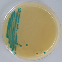 Listeria monozytogenes