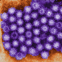 Norovirus (CDC/Charles D. Humphrey)