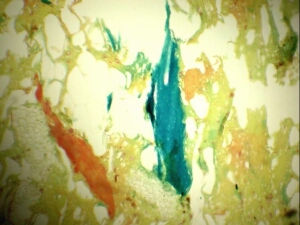 Mikroskopische Ansicht einer Mortadella